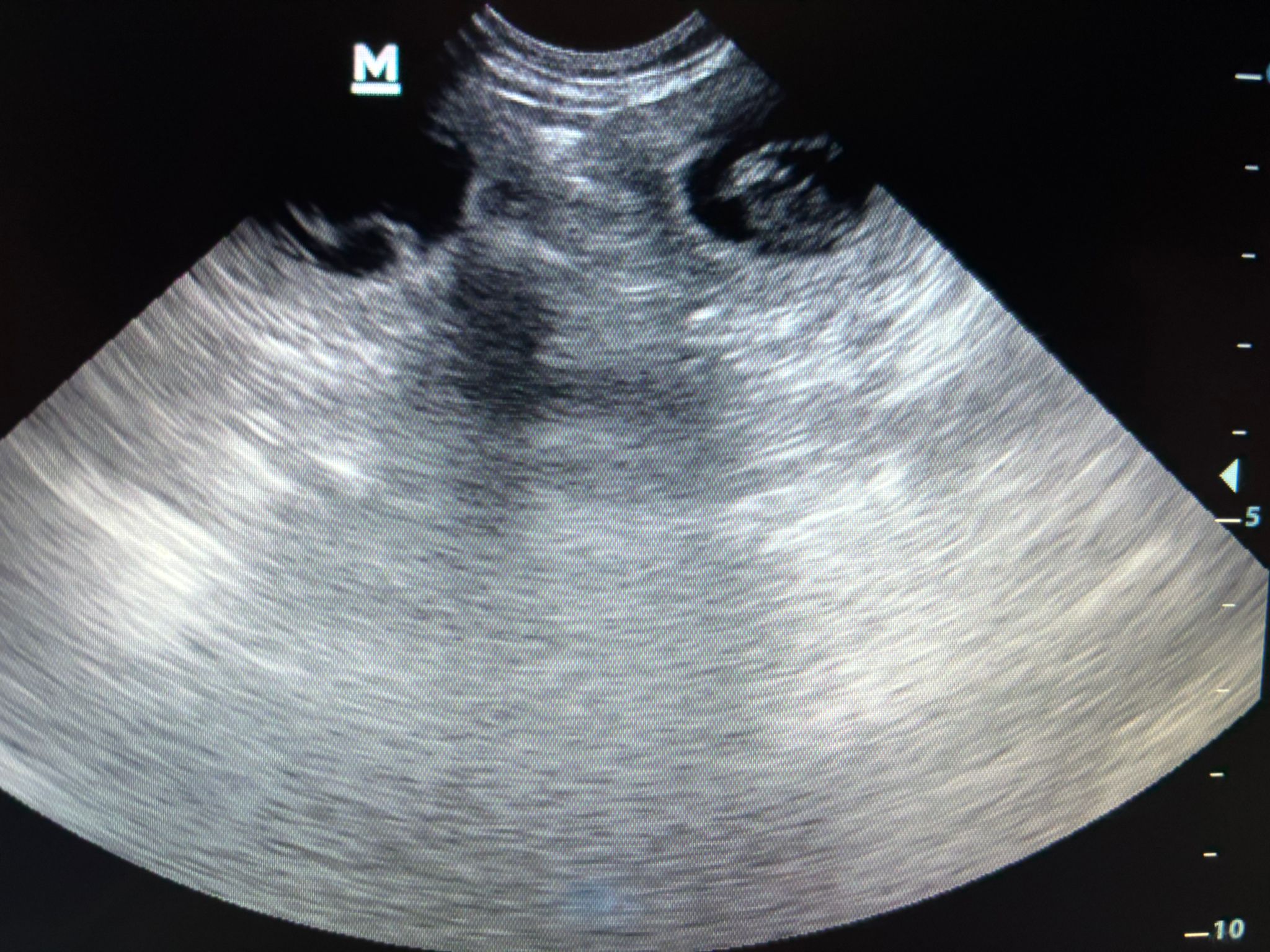 Ultraschall Welpen English Cocker Spaniel Maite vom Nikolausberg 19.2.2026